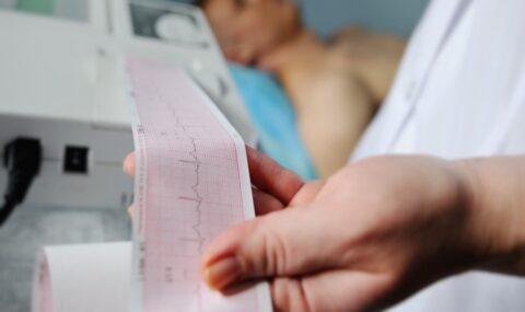 Który aparat ekg wybrać? ucmed
