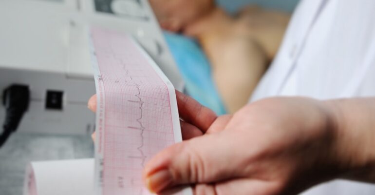 Który aparat ekg wybrać? ucmed