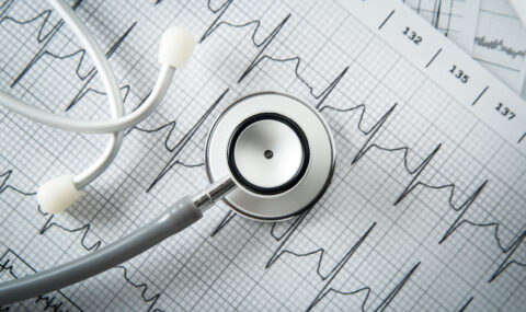 Jak przygotować się na badanie EKG? | UCmed