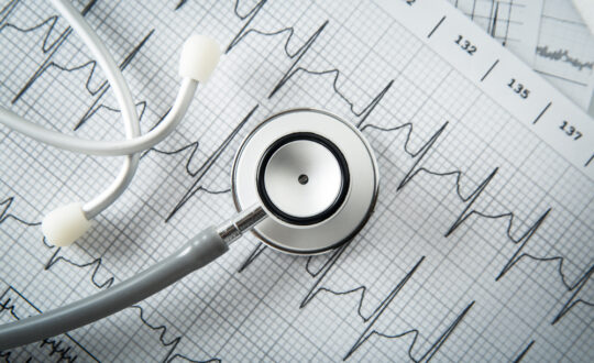 Jak przygotować się na badanie EKG? | UCmed